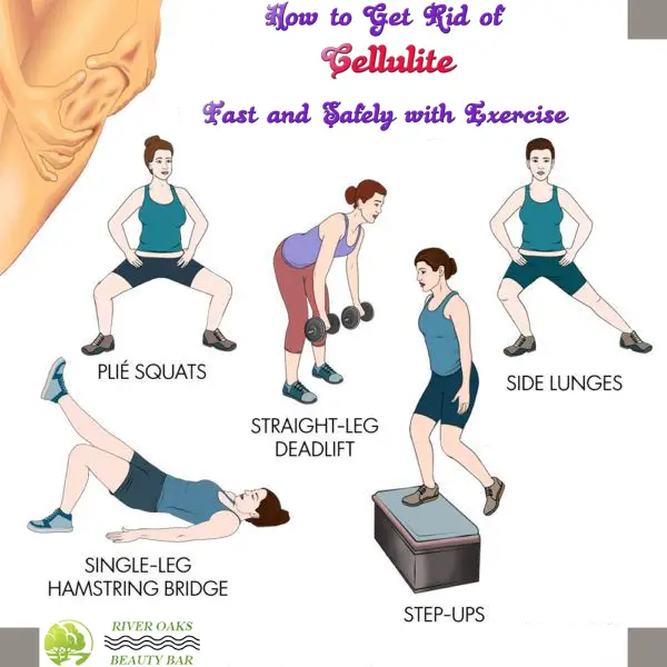 How to Get Rid of Cellulite Fast and Safely