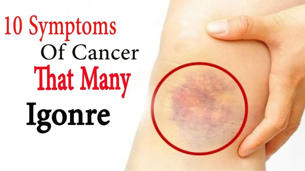 Cancer-Symptoms