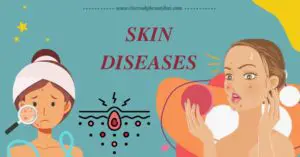 Skin diseases list with pictures